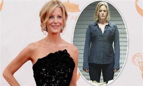 Anna Gunn opens up about her heavily criticised weight gain